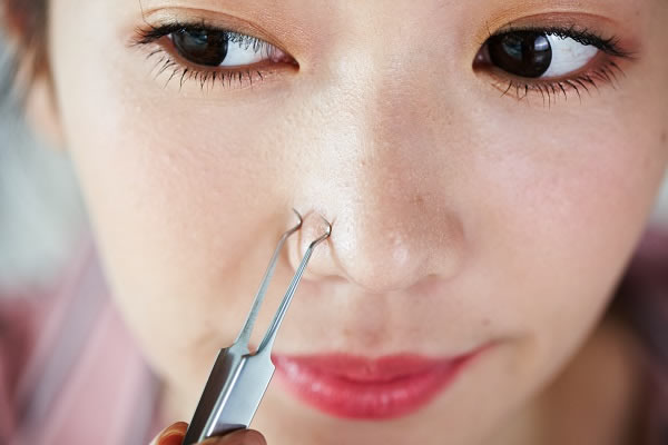 痤疮和痘痘是同一个东西吗？有哪些常见治疗方法?