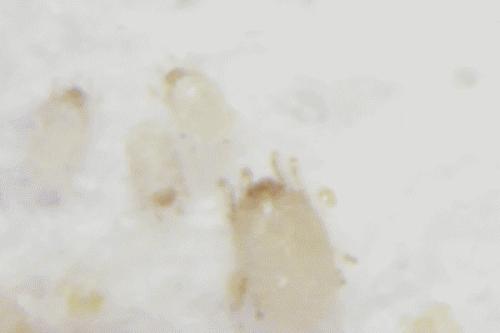 脸上有螨虫怎么办，做好哪些工作才能去除?